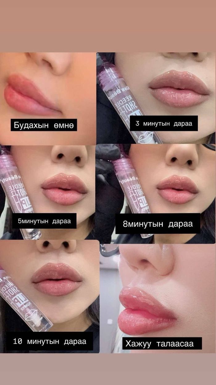 Уруул бомбойлгогч