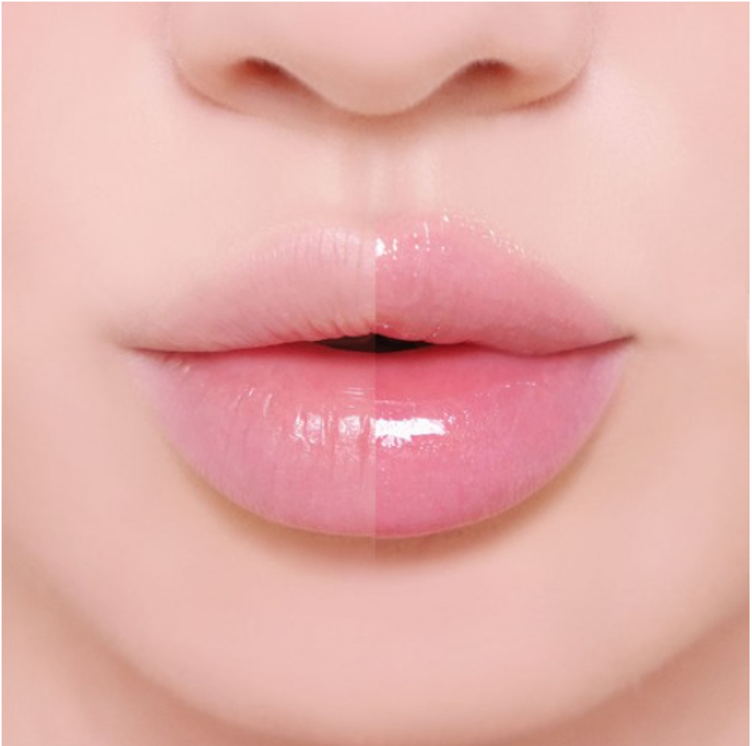 Lip plumper