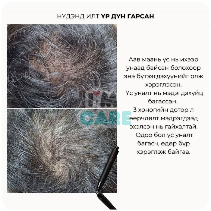 Үс ургуулагчтай багц 