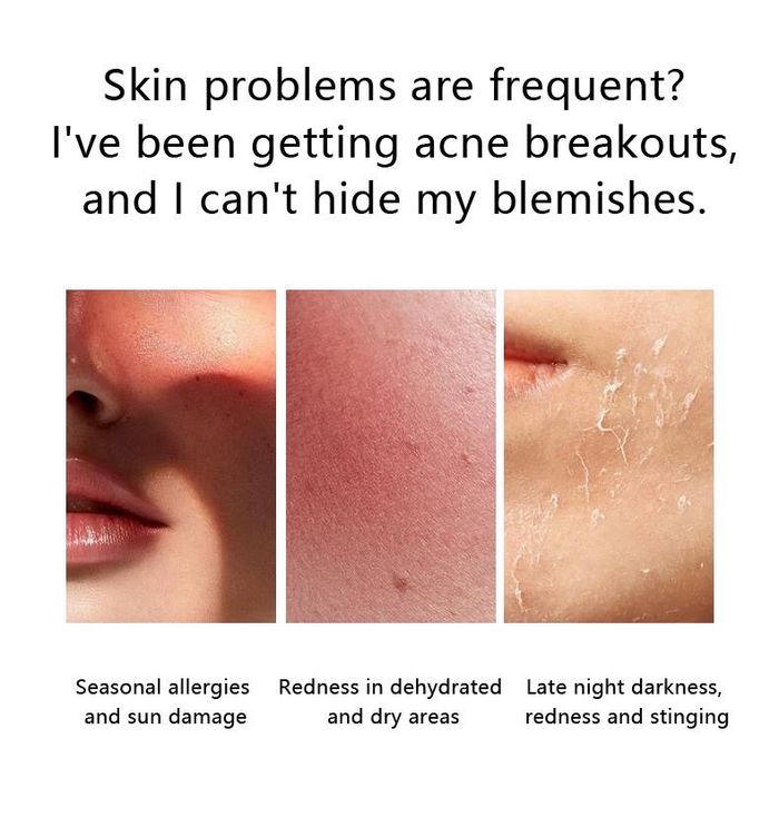 White Skin Арьс өнгөлөгч