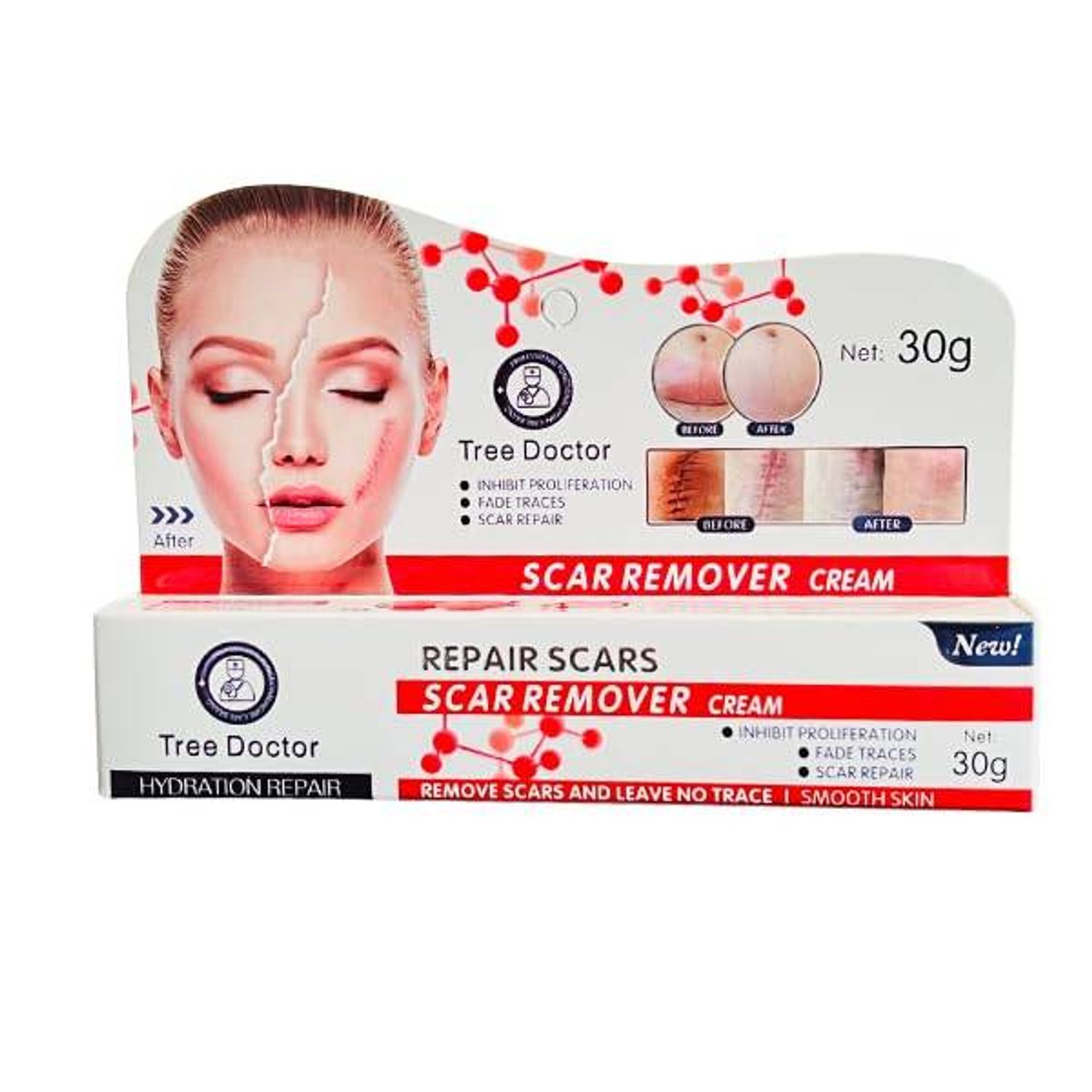 SCAR REMOVER сОРВИ АРИЛГАГЧ