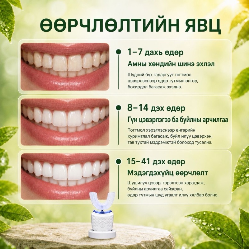 ✅ НИЙТЛЭЛ 4: “Шүд цайруулах үнэтэй эмчилгээ VS гэрийн нөхцөлд ухаалаг сойз – Аль нь илүү үр дүнтэй вэ?”