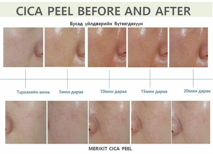 Сика пийл сет