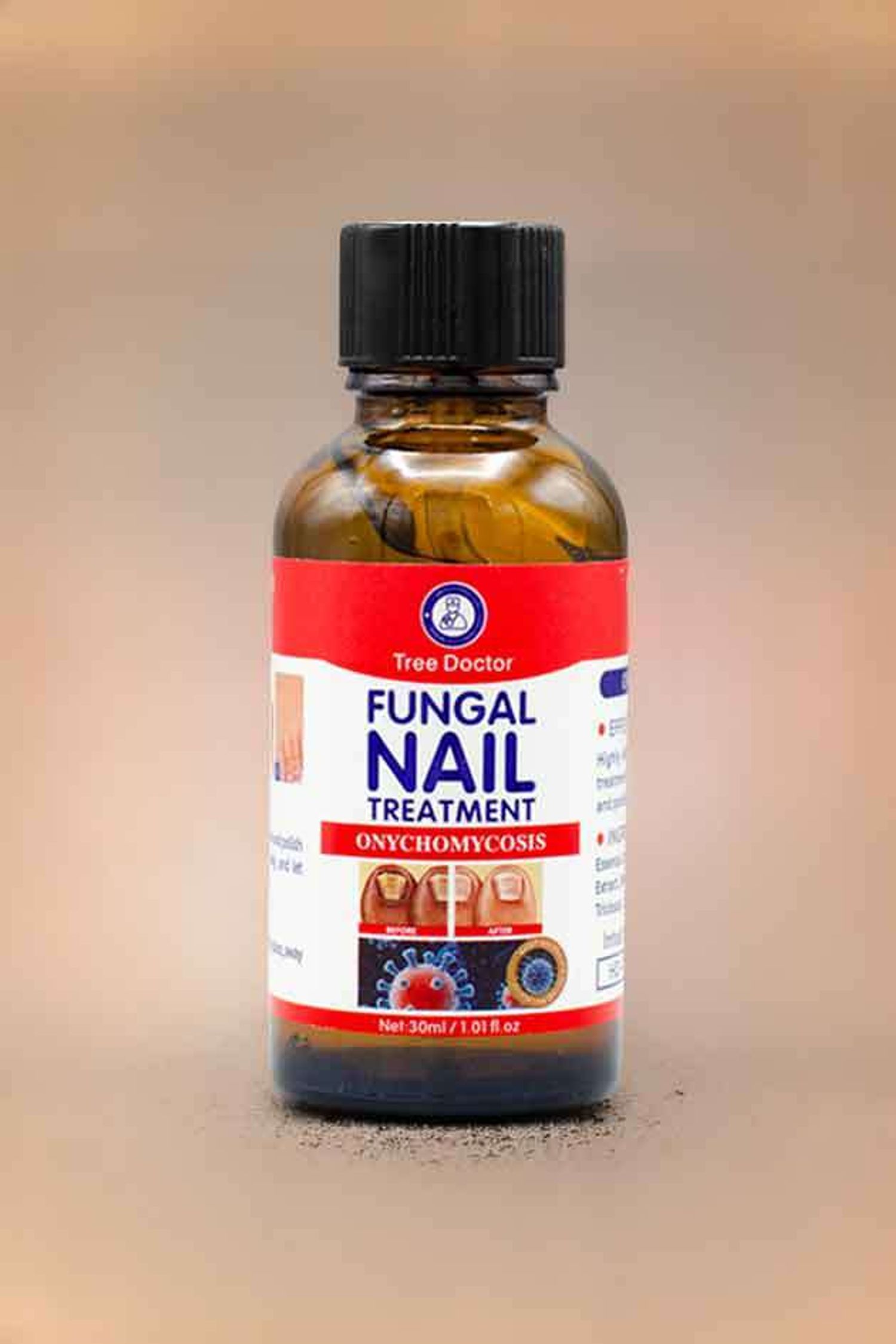 NAIL treatment