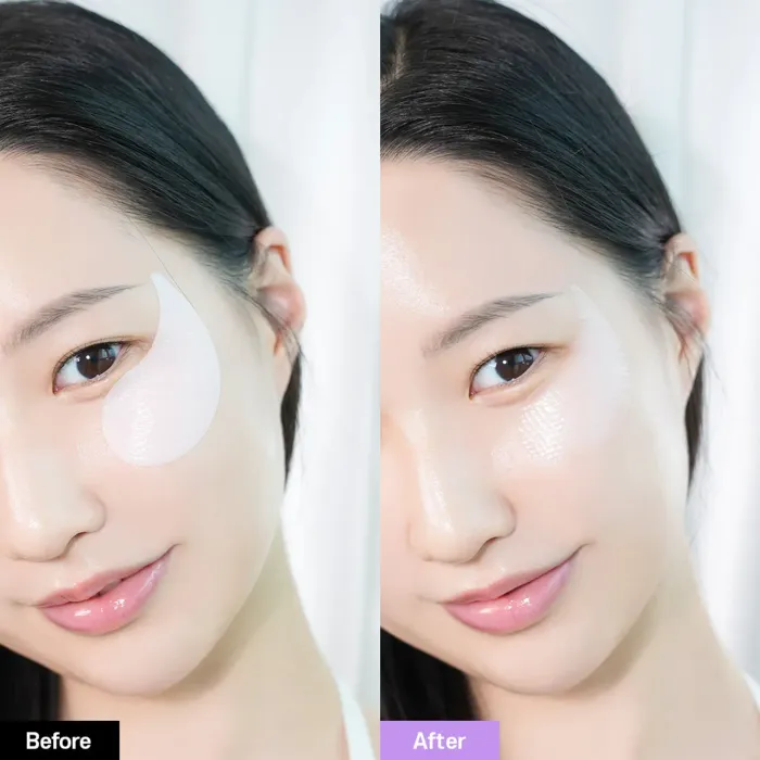 BIOHEAL BOH Probioderm Collagen Remodeling Eye Patch 