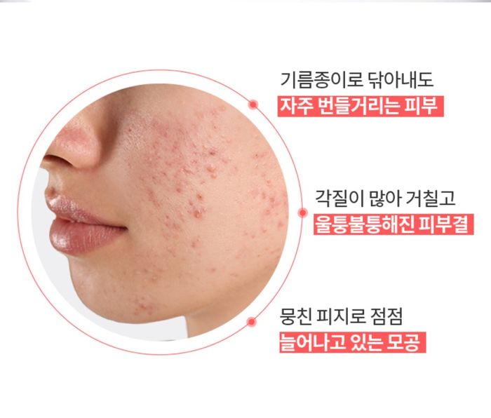 AESTURA THERACNE 365 HYDRO ACTIVE TONER 200ML 