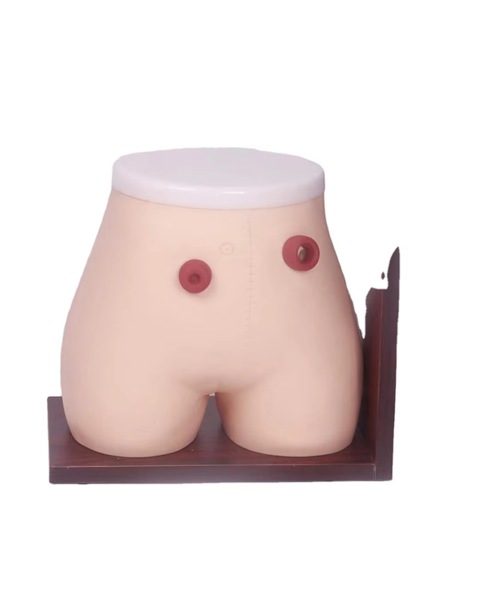 Стома арчилгааны загвар