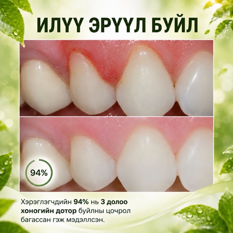 ✅ НИЙТЛЭЛ 8: “Тамхи, кофе их хэрэглэдэг хүмүүст зориулсан шүд арчилгааны зөвлөмж”