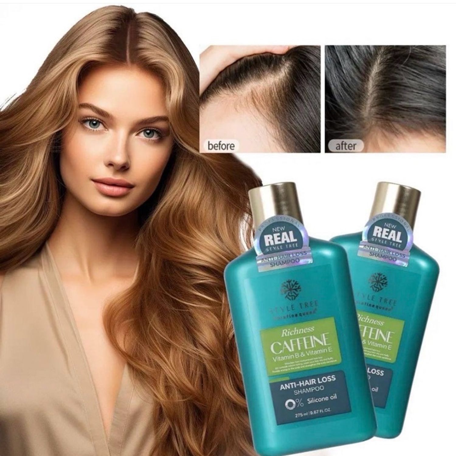 Үс уналтын эсрэг шампунь