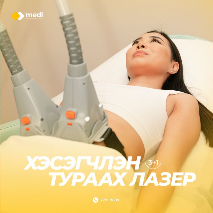 Хэсэгчлэн тураах лазер аппарат