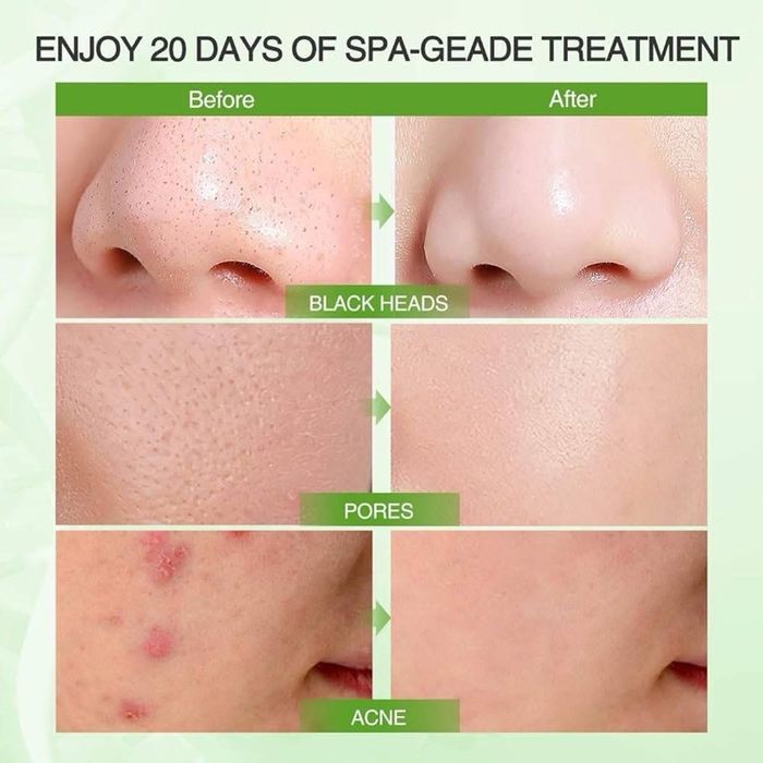 Mung Bean Pore clay mask