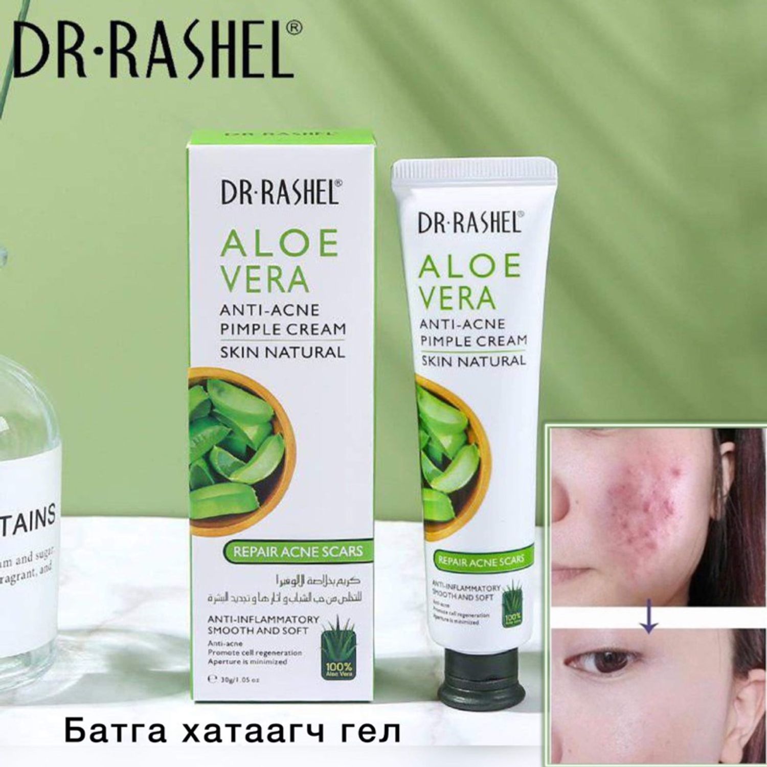 Алое батга хатаагч гел