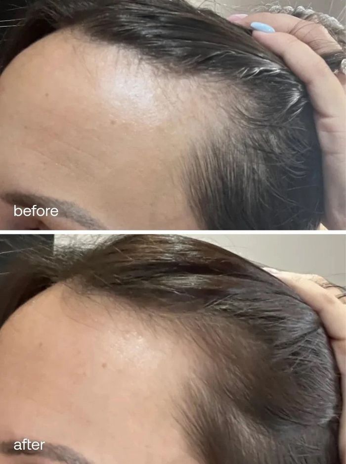 uklash үс ургуулах серум