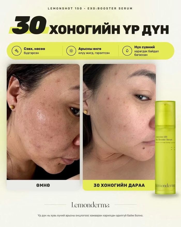 https://cdn.zochil.shop/edb771cf-a5c8-4f69-9b70-682e43a46cac_t700.jpg