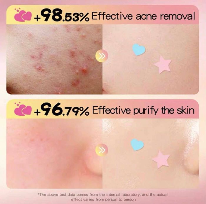 Батганы наалт