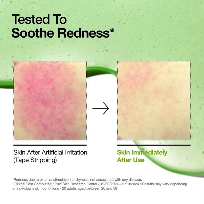 𝐀𝐍𝐔𝐀  #𝐀𝐙𝐄𝐋𝐀𝐈𝐂 𝐀𝐂𝐈𝐃 serum