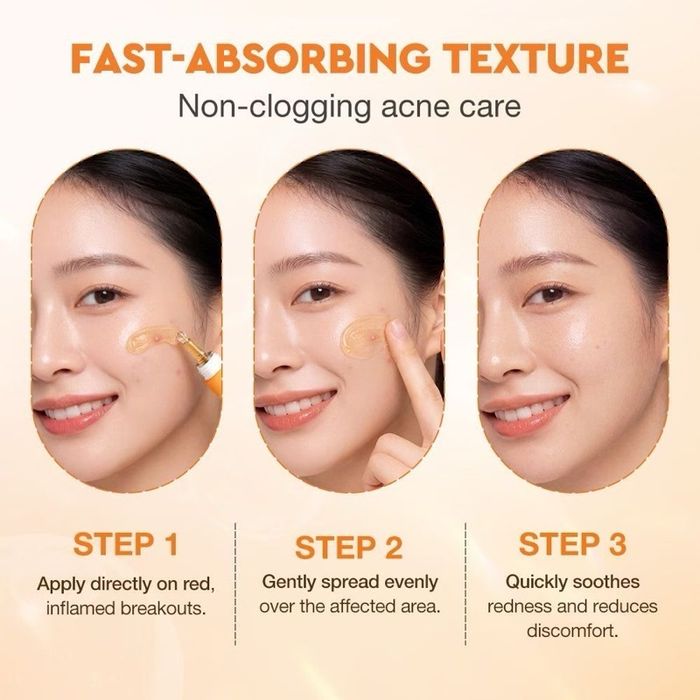 https://cdn.zochil.shop/f28b8313-67ca-4011-9c56-c805a05b36e3_t700.jpg