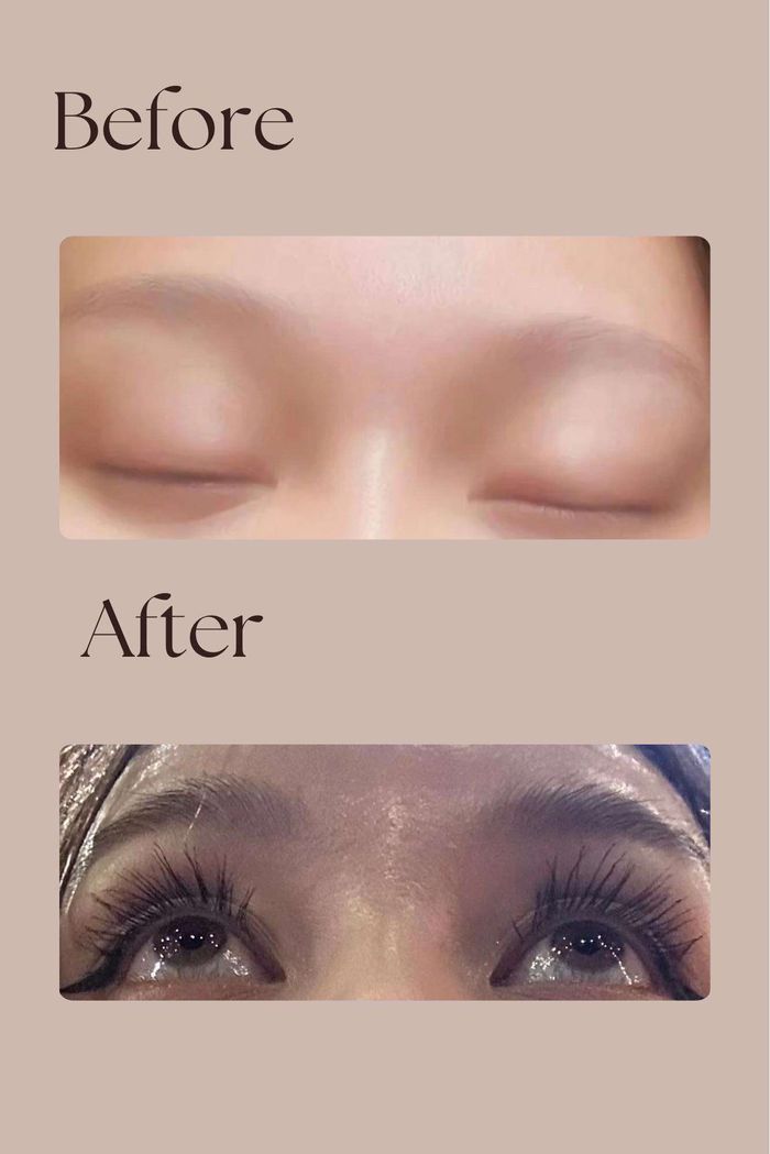 Эрчимтэй Сормуус ургуулагч